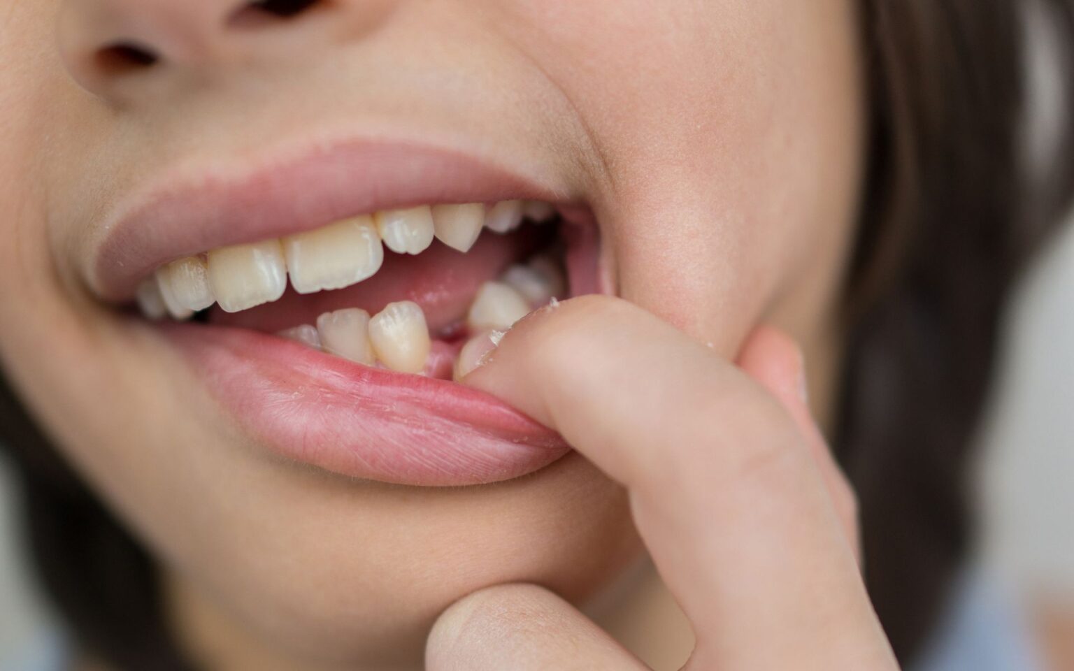 qual o significado de sonhar com dente