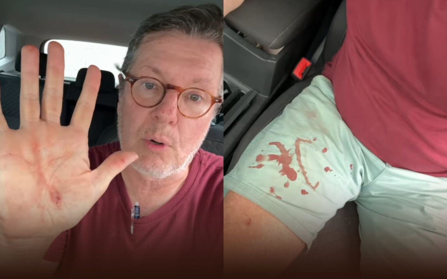 Márcio Gomes se assusta com tentativa de assalto